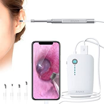 Anykit Otoscope for iPhone and Android